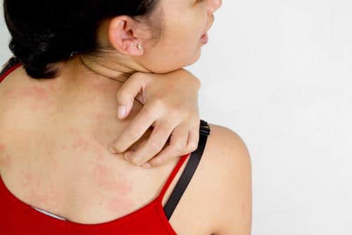 After a rash has grown or persisted, you should seek out medical expertise immediately.