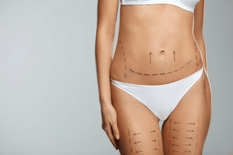 body contouring specialist