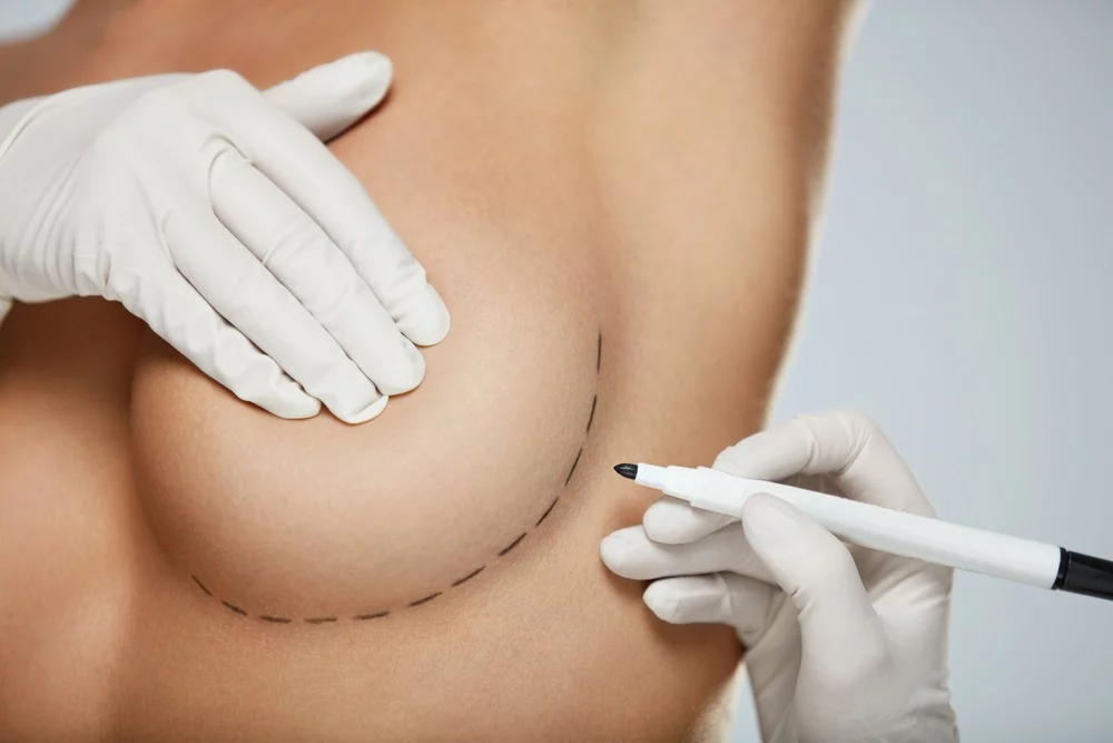 breast augmentation in Glen Burnie, MD